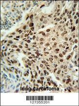 Anti-PRNIP (C-term) Antibody