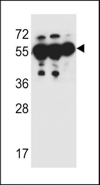 Anti-ANKRD57 (C-term) Antibody