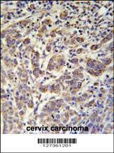 Anti-ANKRD57 (C-term) Antibody