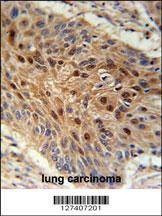Anti-C4orf31 (N-term) Antibody