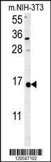 Anti-LSM4 (Center) Antibody