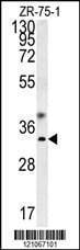 Anti-GCH1 (N-term) Antibody
