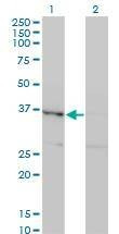 Anti-HHEX Antibody