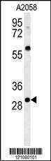 Anti-GSTO2 (Center) Antibody