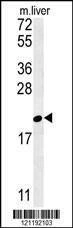 Anti-GM2A (N-term) Antibody