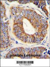 Anti-DNAJA1 (Center) Antibody