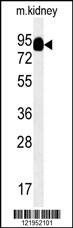 Anti-MEP1A (N-term) Antibody