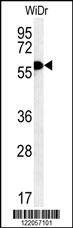 Anti-TANK (Center) Antibody