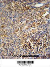Anti-TANK (Center) Antibody
