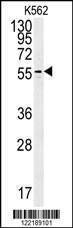 Anti-PAOX (Center) Antibody
