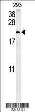 Anti-TAC1 (C-term) Antibody