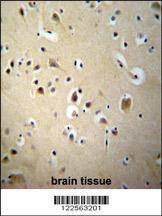 Anti-SIAH2 (Center) Antibody