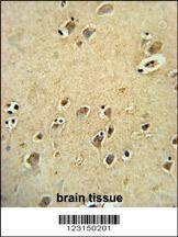 Anti-DIRAS3 Antibody