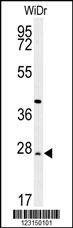 Anti-DIRAS3 Antibody