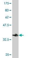 Anti-HIP1R Antibody