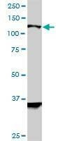 Anti-HIP1R Antibody