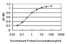 Anti-HIP1R Antibody