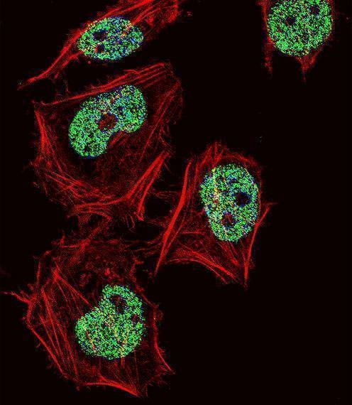 Anti-CUX1 (C-term) Antibody