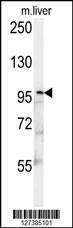 Anti-KIF9 (C-term) Antibody