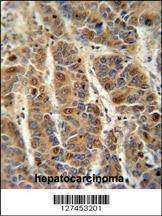 Anti-C4BPA (C-term) Antibody