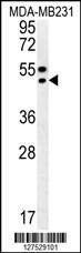 Anti-TRAM2 (C-term) Antibody