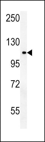 Anti-OTUD4 (N-term) Antibody