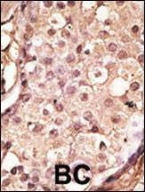 Anti-ACE2 (SARS Receptor) (Center) Antibody