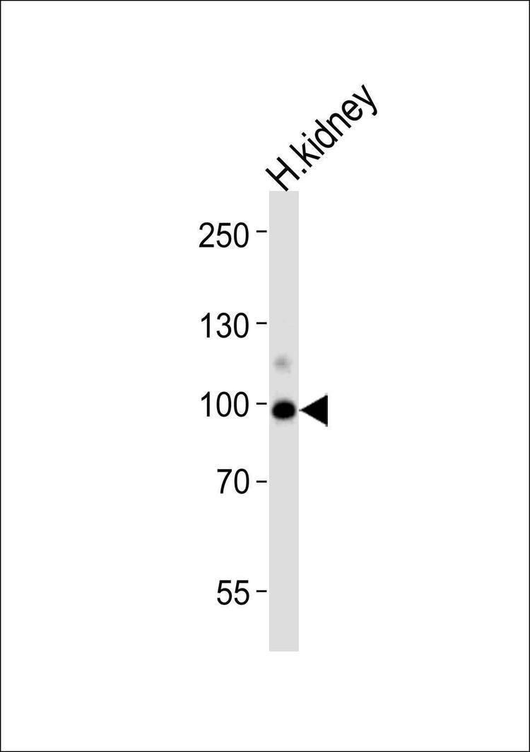 Anti-ACE2 (SARS Receptor) (Center) Antibody