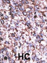 Anti-BACE2C (C-term) Antibody