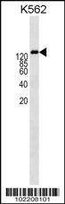 Anti-P-Glycoprotein (ABCB1) (Center) Antibody