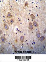 Anti-cIAP2 (BIRC3) (N-term) Antibody
