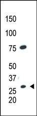 Anti-CDX1 (C-term) Antibody