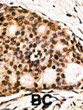 Anti-CDX1 (C-term) Antibody