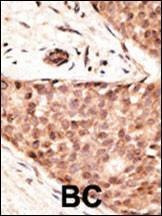 Anti-CDX2 (N-term) Antibody