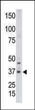Anti-CDX2 (N-term) Antibody