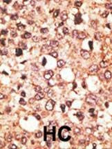 Anti-Cry1 (C-term) Antibody