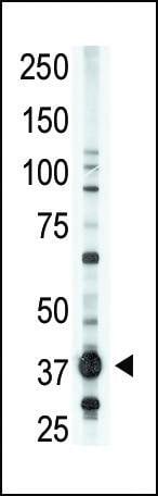 Anti-EDG2 (N-term) Antibody