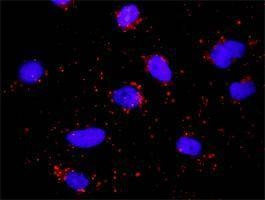 Anti-HLA-DQA1 Antibody