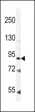 Anti-Leptin Receptor (LEPR) (N-term) Antibody