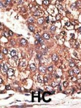Anti-Leptin Receptor (LEPR) (N-term) Antibody