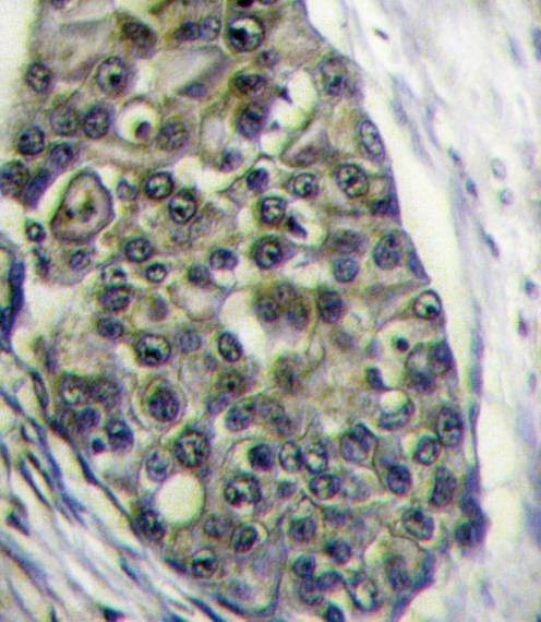 Anti-LRP6 (C-term T1546) Antibody