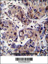 Anti-MAGEA3 (C-term) Antibody