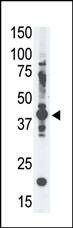 Anti-MAGEA4 (N-term) Antibody