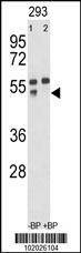 Anti-MMP12 (C-term) Antibody