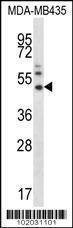 Anti-MMP16 (N-term) Antibody