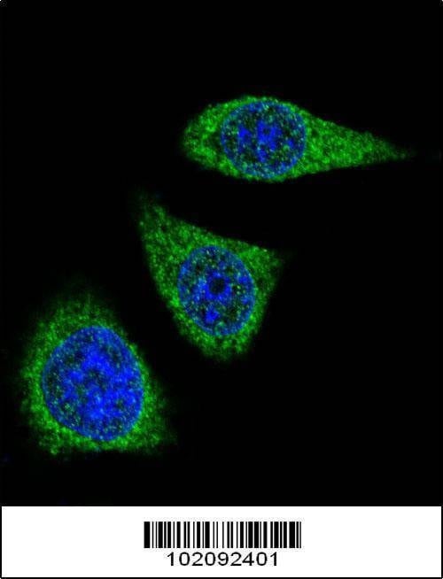 Anti-MMP7 (Center) Antibody