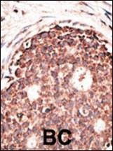 Anti-MMP9 (C-term) Antibody