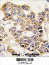 Anti-MMP9 (C-term) Antibody