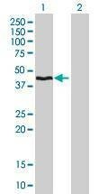 Anti-HMBS Antibody