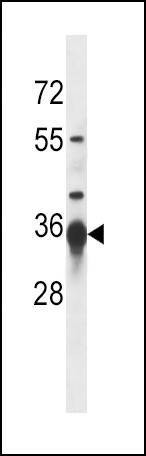 Anti-SIRT3 (C-term) Antibody